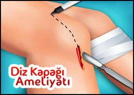 Diz Kapağı Ameliyatı